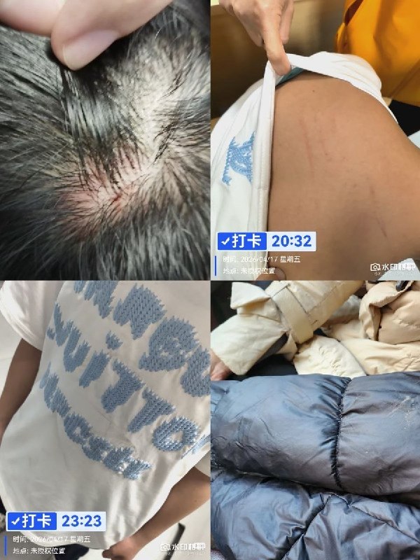 5月31日，山西长治市潞州区一名家长发文反映称，其孩子在校期间长期遭到同一伙学生围堵、殴打，疑似多次遭受校园霸凌