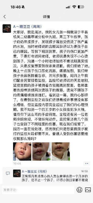 “丰县机关二幼老师用热熔胶笔烫孩子的嘴”5月27日，江苏省徐州市，丰县机关二幼翡翠园分校中九班，发生虐童事件