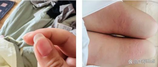 近日，一名前B站项目经理刘女士指控在三亚出差期间被某单位宣传处助理员邵某某强奸