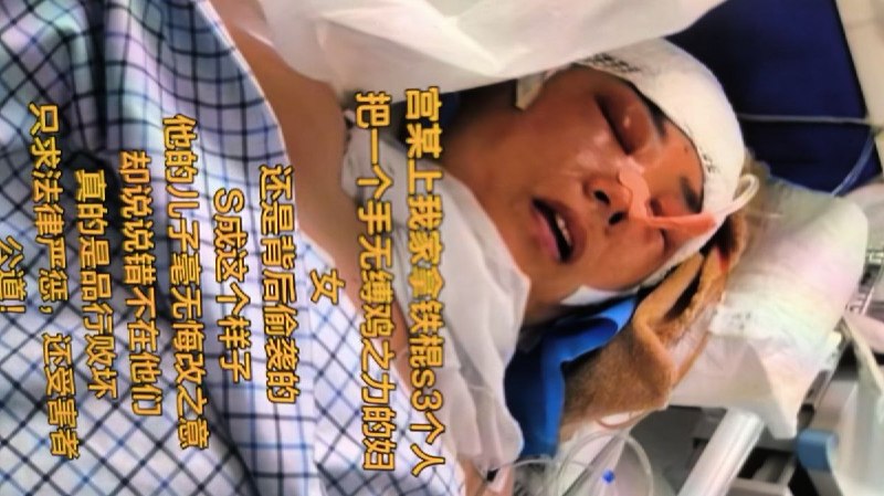 网友投稿：2025年7月16日辽宁省丹东市东港市孤山镇宫家屯村，因土地纠纷，发生严重暴力事件，立案后长期不处理不作为