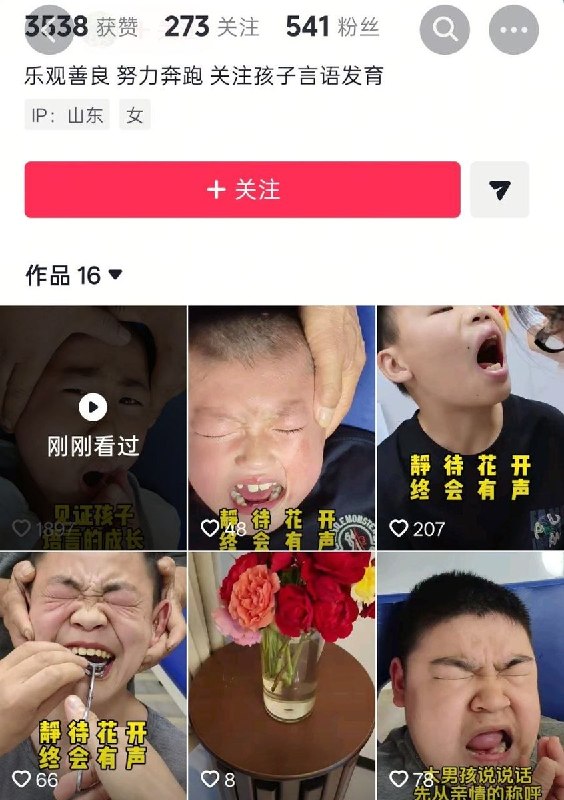 家长因孩子说话晚寻求“特殊治疗”孩子被针刺口腔和眉心近日，山东一名家长带孩子接受所谓“特殊治疗”，一名儿童被两名成年人控制住身体，其中一人按住孩子头部，另一人手持细针，对孩子口腔及眉心部位进行针刺，孩子因疼痛不断哭泣、流泪