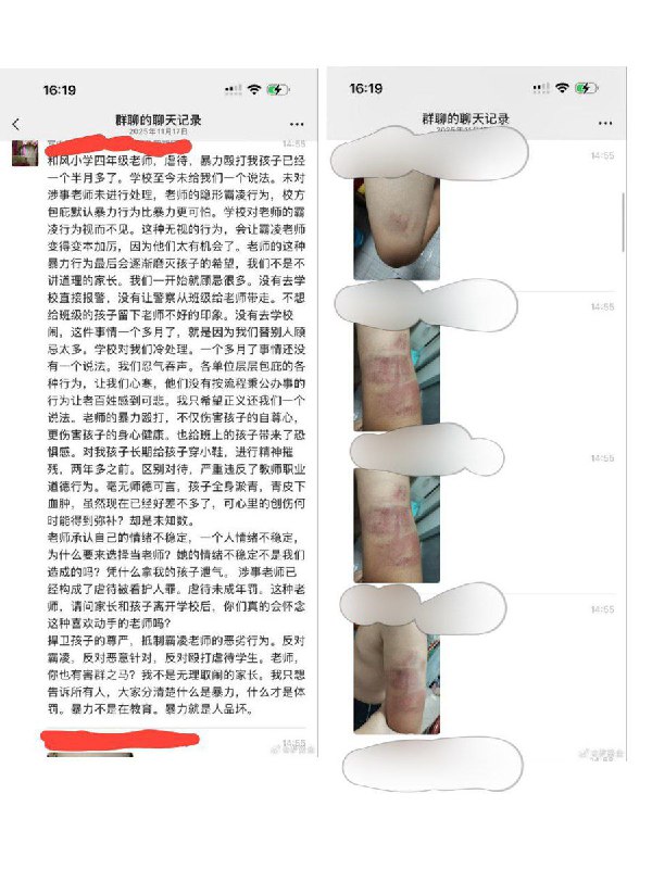 因国庆遗失两张试卷，一学生被老师多次殴打、推拽、踢倒，造成皮下血肿和心理问题