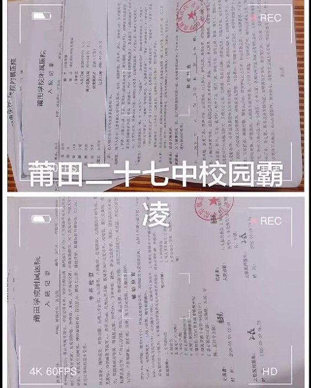 福建莆田二十七中发生恶性校园霸凌 ，3人持指虎将同学打至重伤，家长账号发声后被禁言